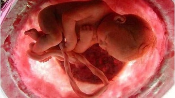 Молочница и зачатие ребенка возможно thumbnail