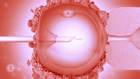 Донорские яйцеклетки москва. ИКСИ оплодотворение. Оплодотворение яйцеклетки ИКСИ. Эко экстракорпоральное оплодотворение.